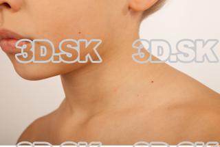 Neck texture of Lon 0009